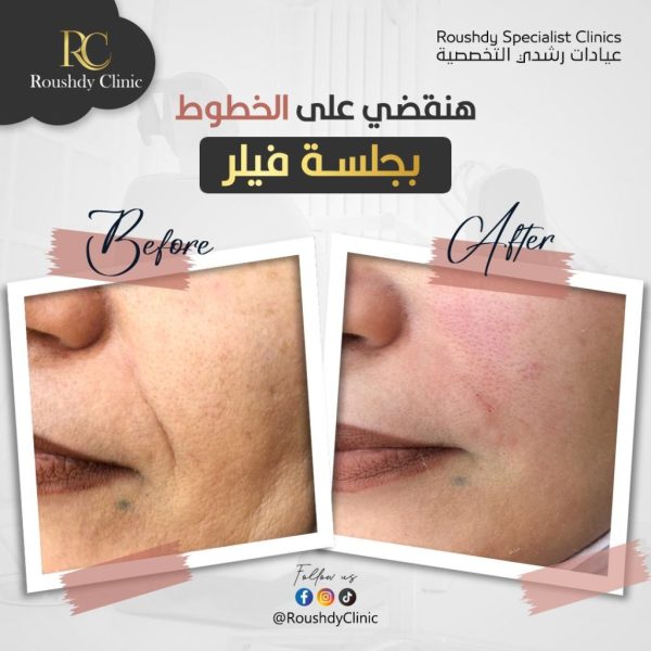 roushdy clinics - beauty-cases-001