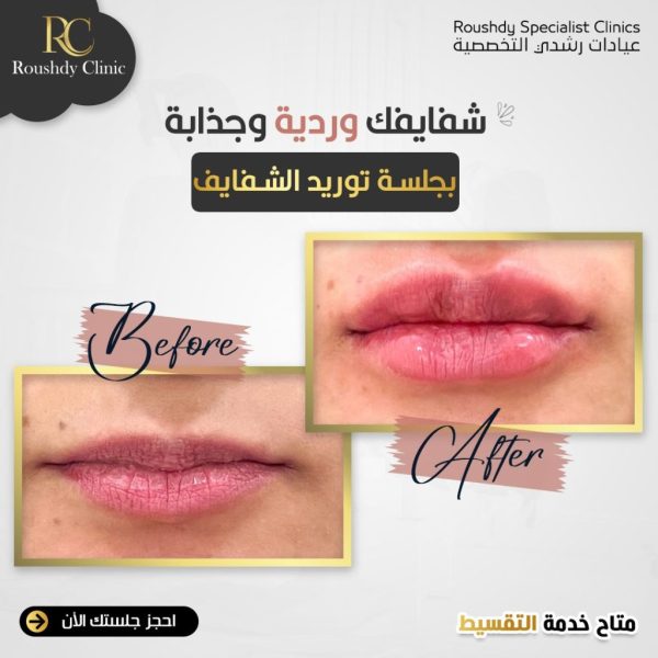 roushdy clinics - beauty-cases-002