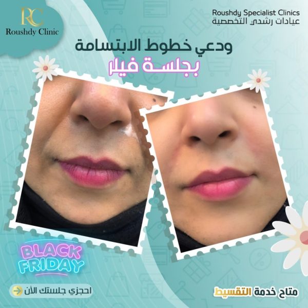 roushdy clinics - beauty-cases-003