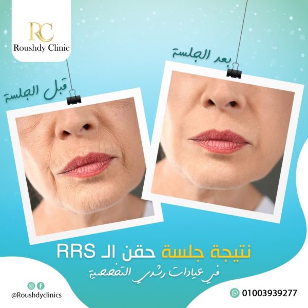 roushdy clinics - beauty-cases-004