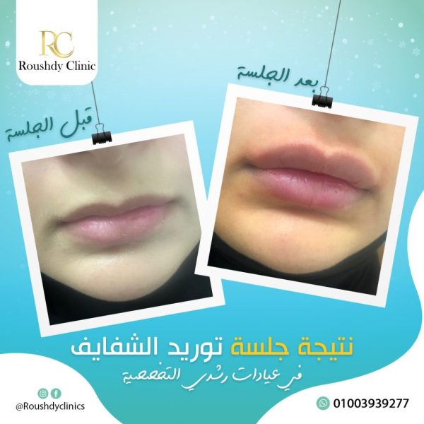 roushdy clinics - beauty-cases-005