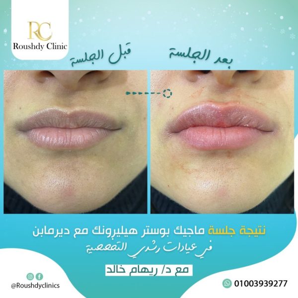 roushdy clinics - beauty-cases-006