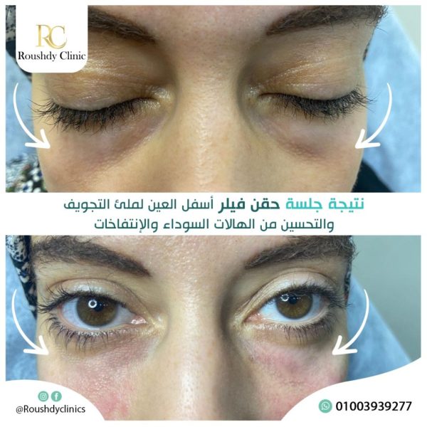 roushdy clinics - beauty-cases-007