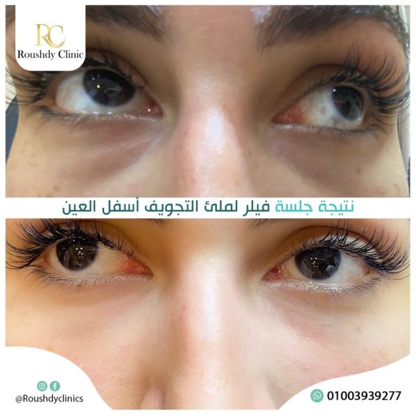 roushdy clinics - beauty-cases-008