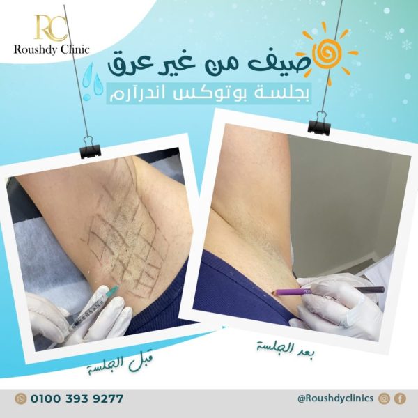 roushdy clinics - beauty-cases-009