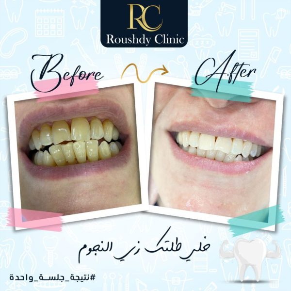 roushdy clinics - dental-cases-001