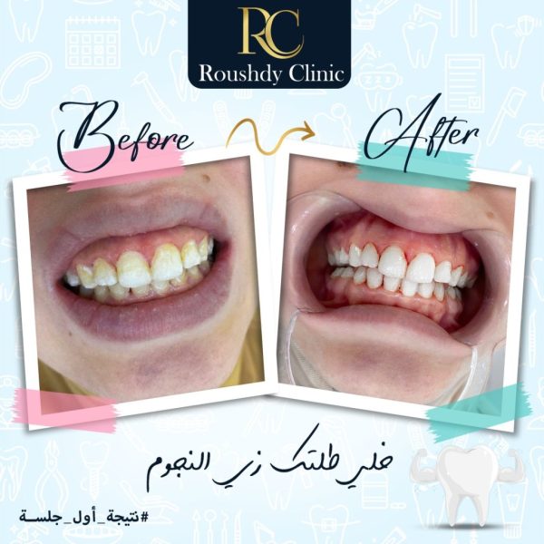 roushdy clinics - dental-cases-002