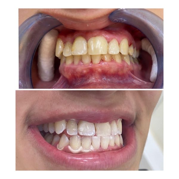 roushdy clinics - dental-cases-005