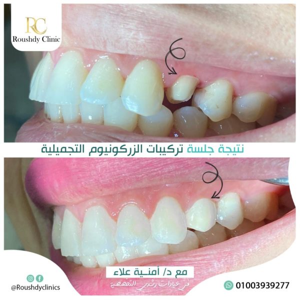 roushdy clinics - dental-cases-012