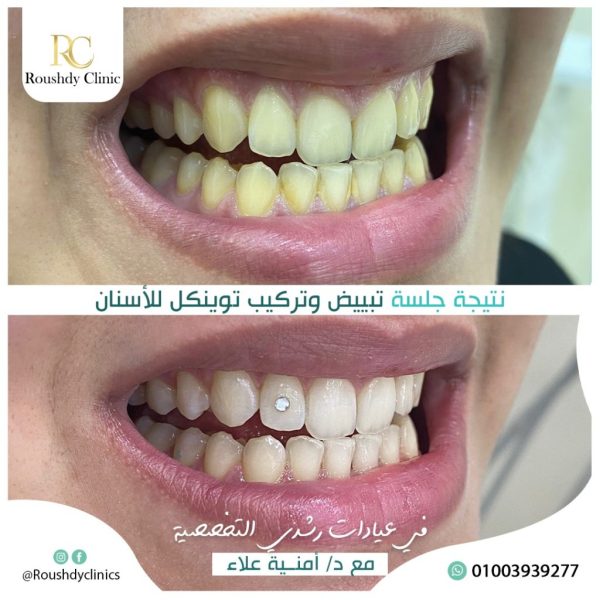 roushdy clinics - dental-cases-013